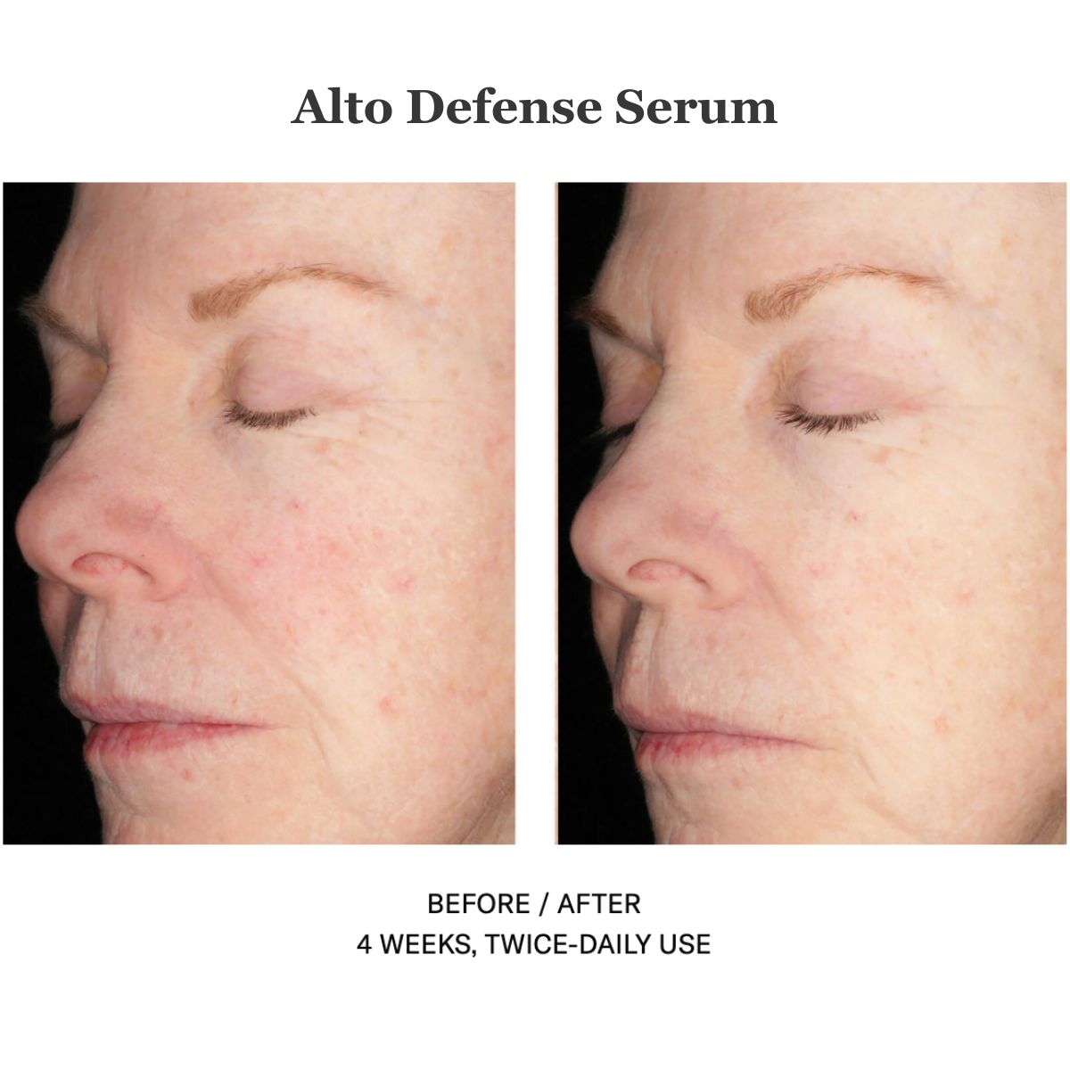 Alto Defense Serum 30ml