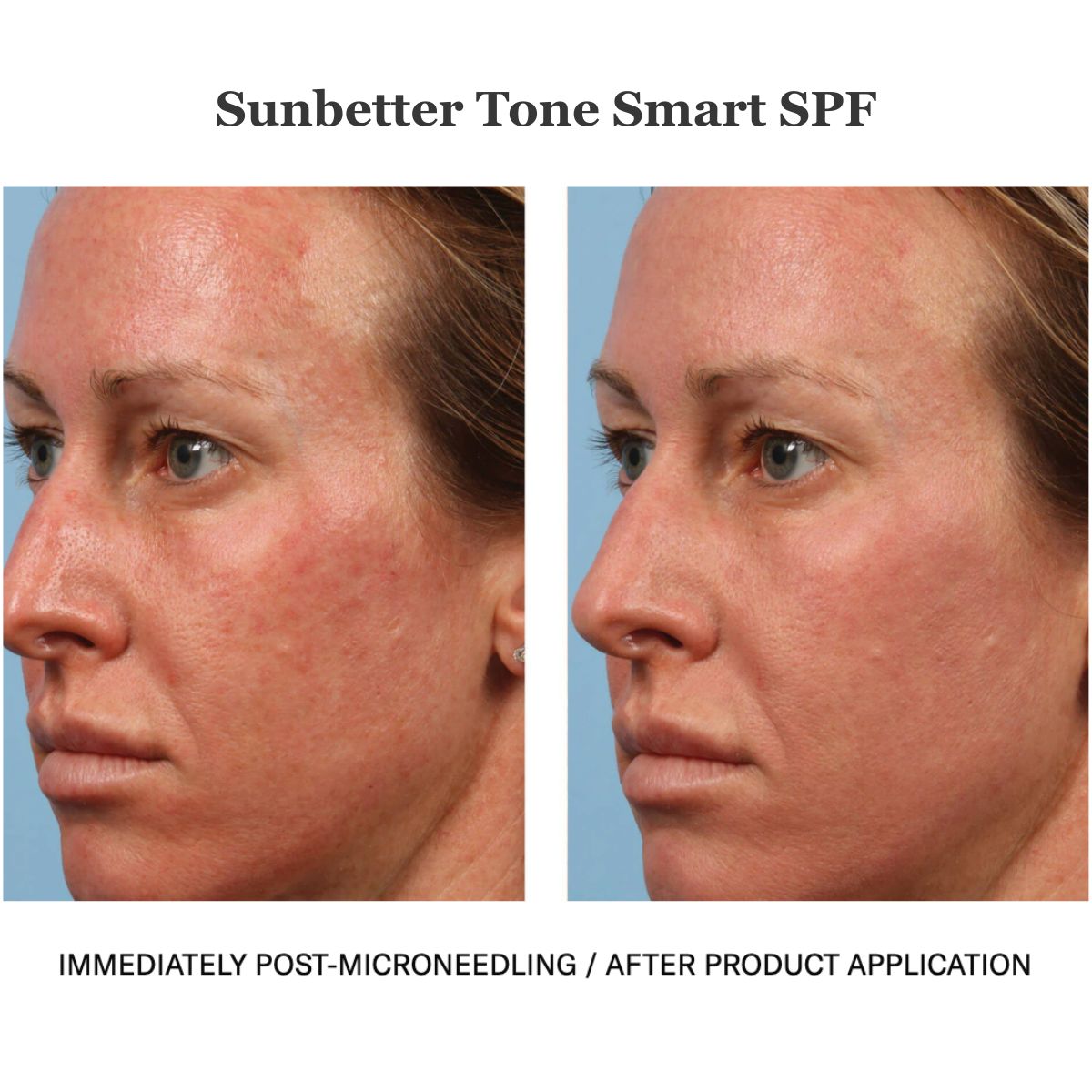 Tone Smart SPF50+ Sunscreen Compact 12g