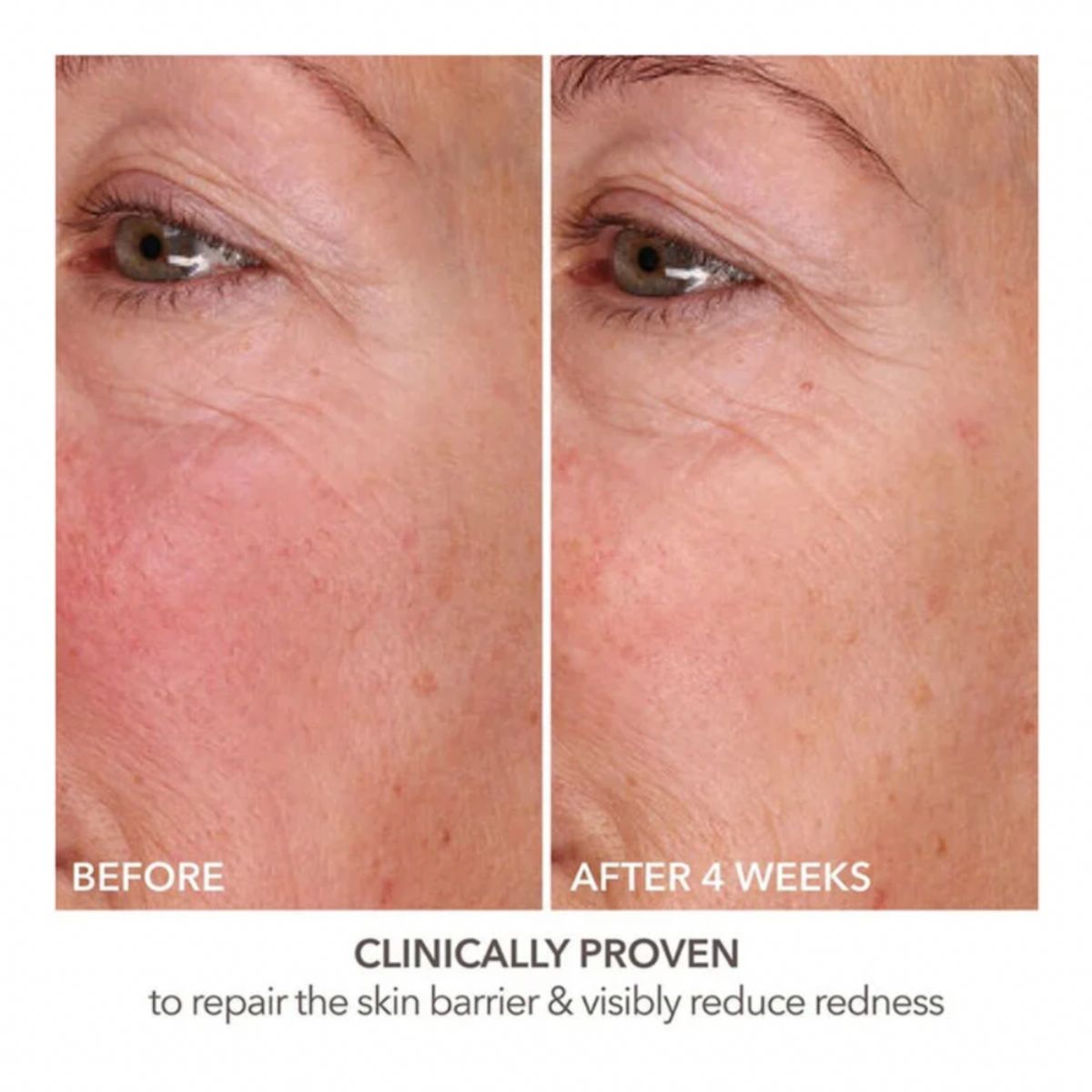 Fill + Repair Serum 30ml