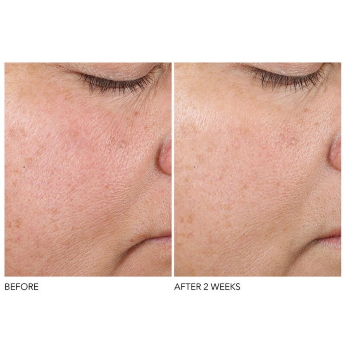 Texture Renewal Serum 30ml