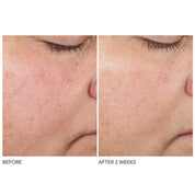 Texture Renewal Serum 30ml