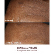 Intense Wrinkle Cream 60ml