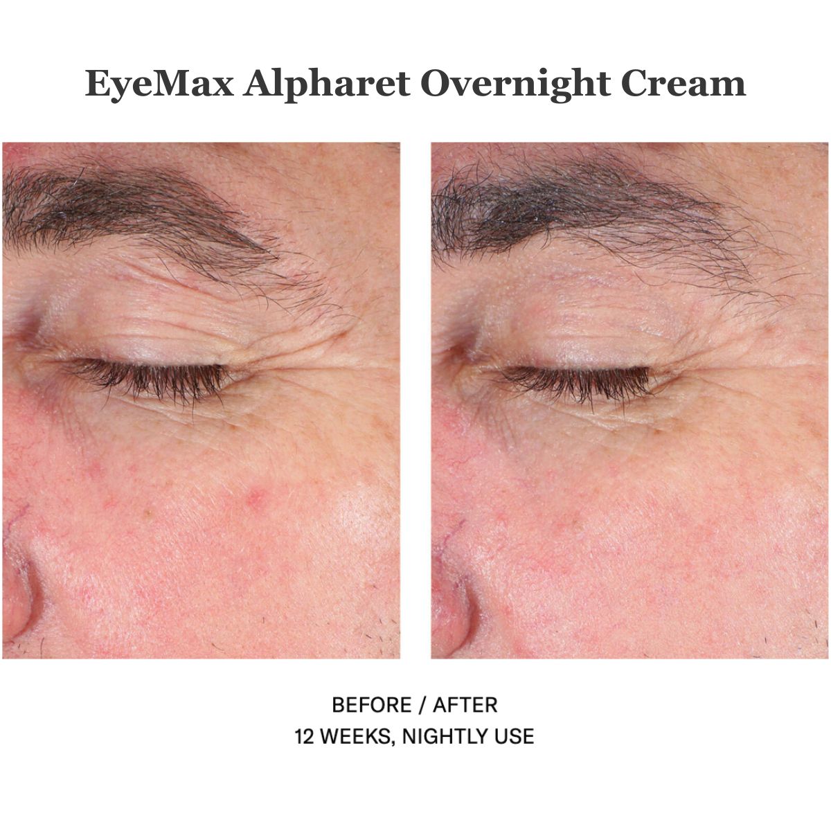 EyeMax Alpharet Overnight Cream 15ml