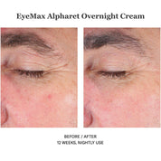 EyeMax Alpharet Overnight Cream 15ml