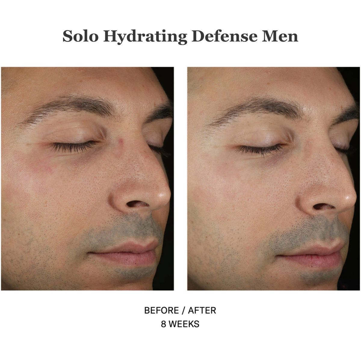 Solo Hydrating Defense Men 30ml