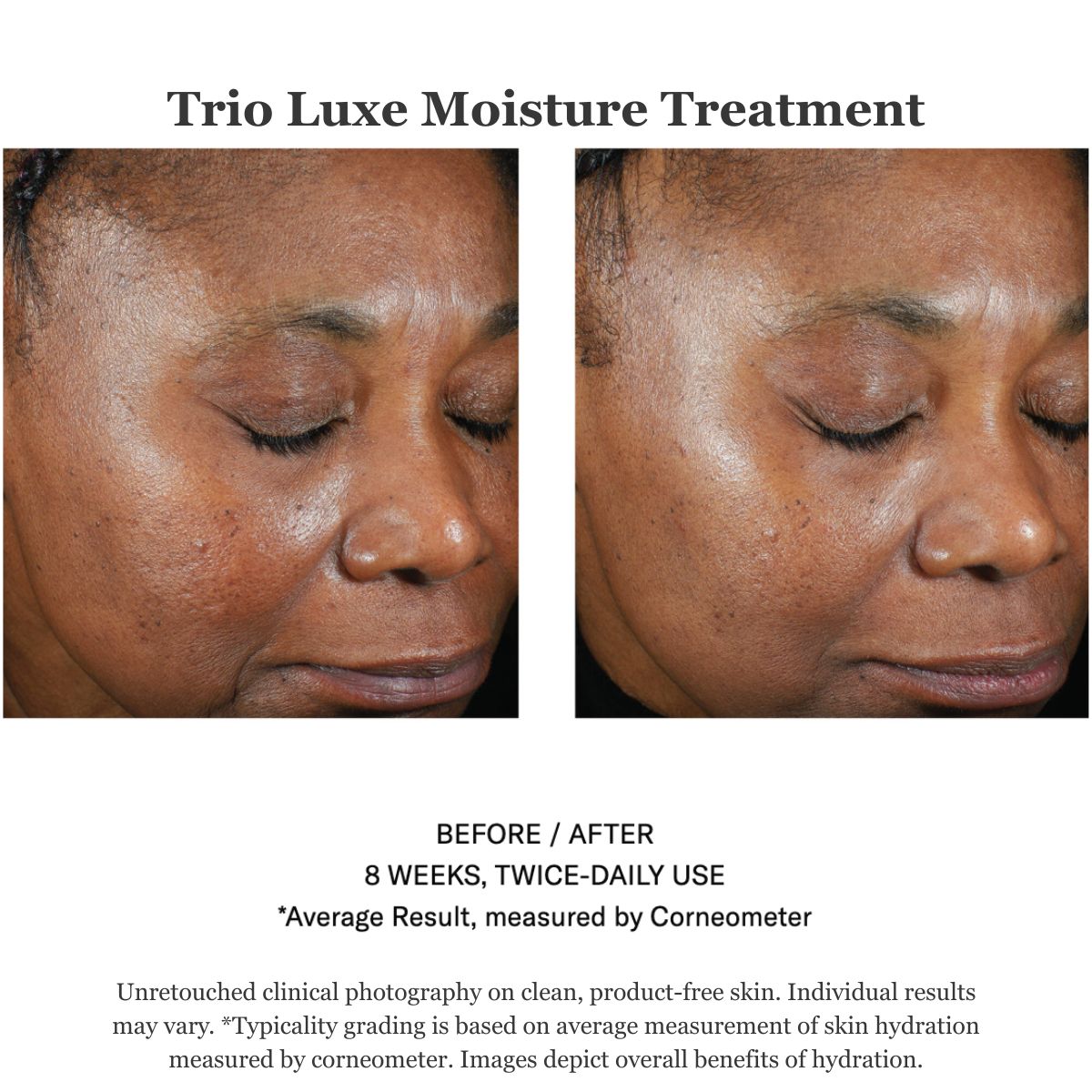 Trio Luxe Moisture Treatment 50ml