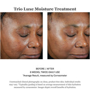 Trio Luxe Moisture Treatment 50ml