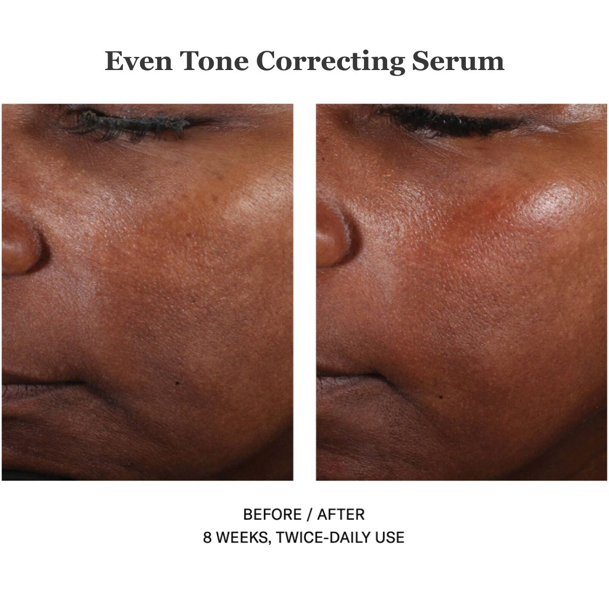 Even Tone Correcting Serum 50ml