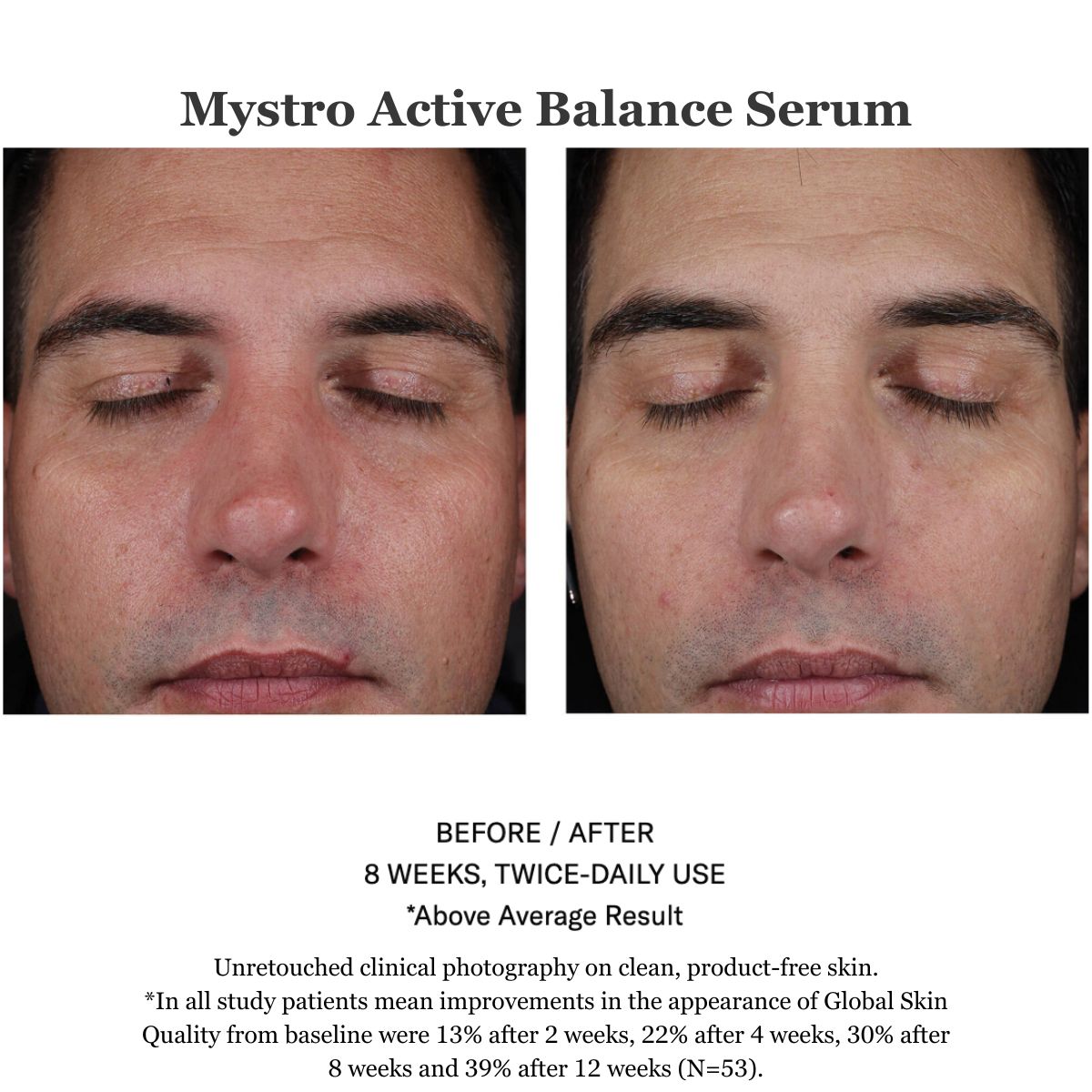 Mystro Active Balance Serum 30ml