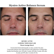 Mystro Active Balance Serum 30ml
