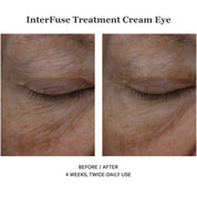 InterFuse Treatment Cream Eye 15ml