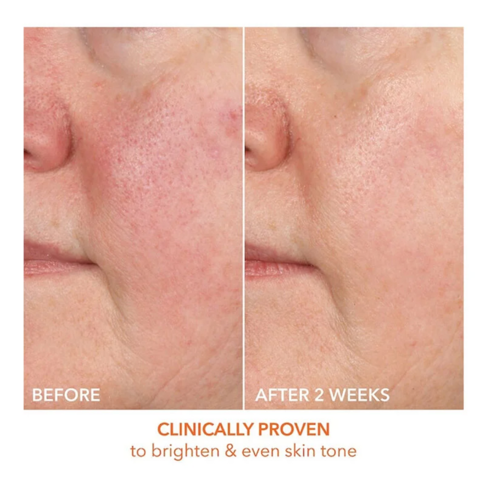 15% Vitamin C Firm & Bright Serum 30ml
