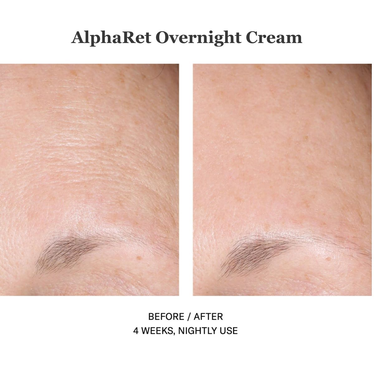 Alpharet Overnight Cream 30ml