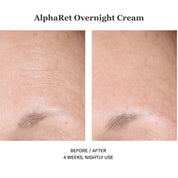 Alpharet Overnight Cream 30ml