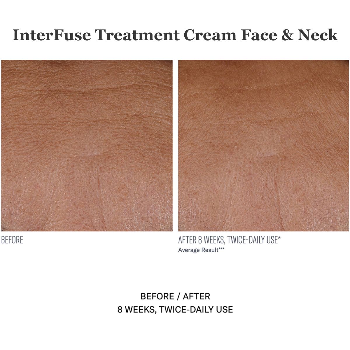InterFuse Treatment Cream Face & Neck 30ml