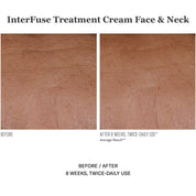 InterFuse Treatment Cream Face & Neck 30ml