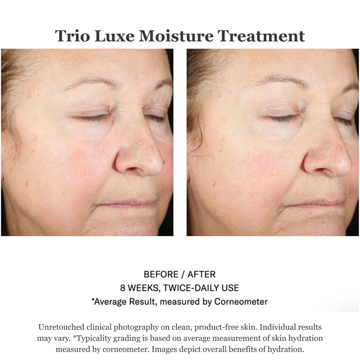 Trio Luxe Moisture Treatment 50ml