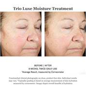 Trio Luxe Moisture Treatment 50ml