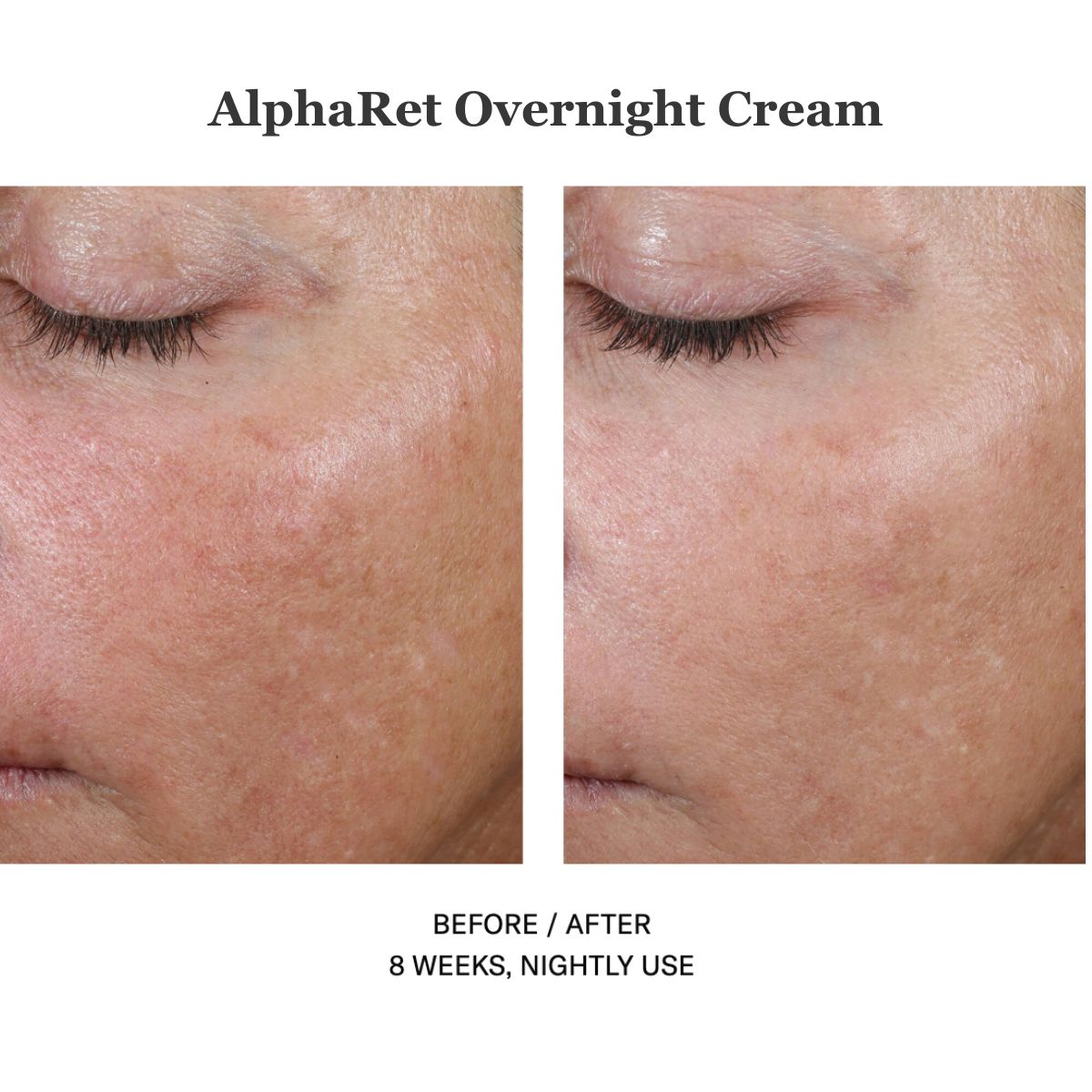 Alpharet Overnight Cream 30ml