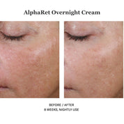 Alpharet Overnight Cream 30ml