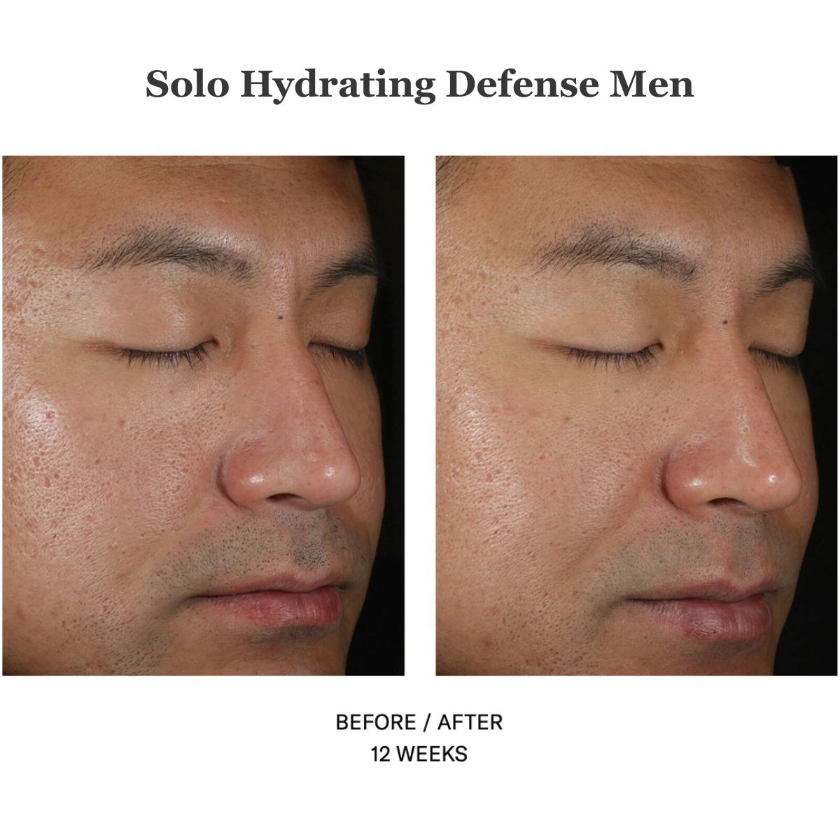 Solo Hydrating Defense Men 30ml