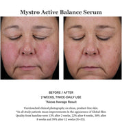 Mystro Active Balance Serum 30ml