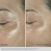 ELASTIderm Eye Cream 15g