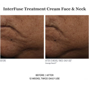 InterFuse Treatment Cream Face & Neck 30ml