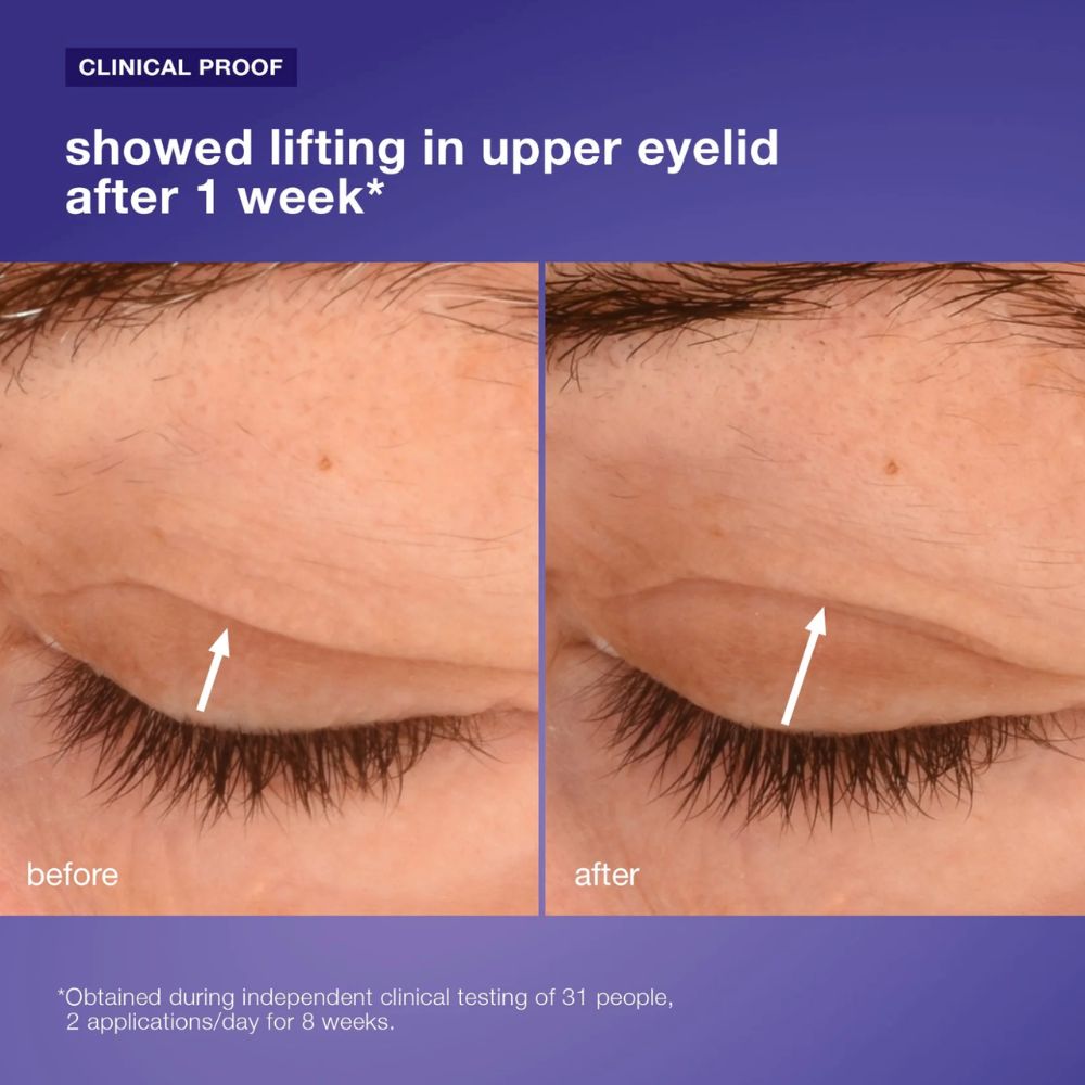 Phyto Nature Lifting Eye Cream 15ml