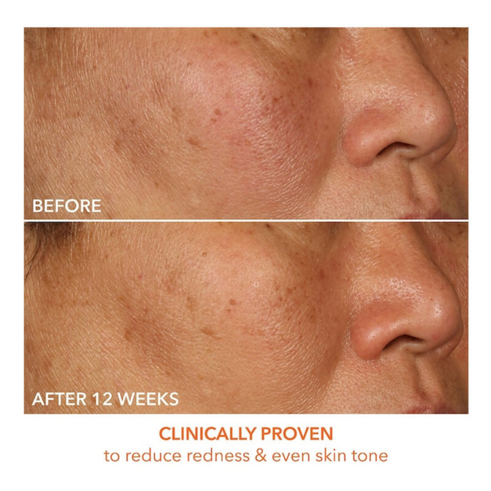 15% Vitamin C Firm & Bright Serum 30ml