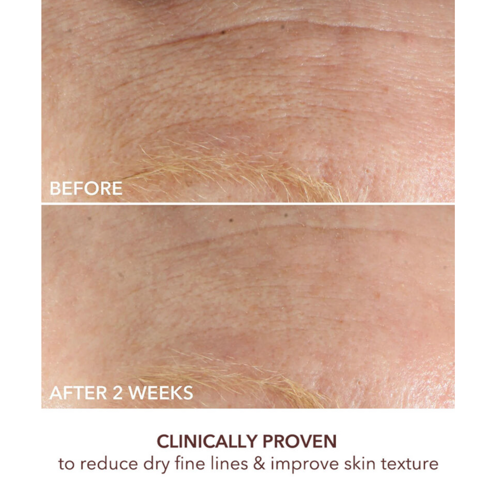 Intense Wrinkle Cream 60ml