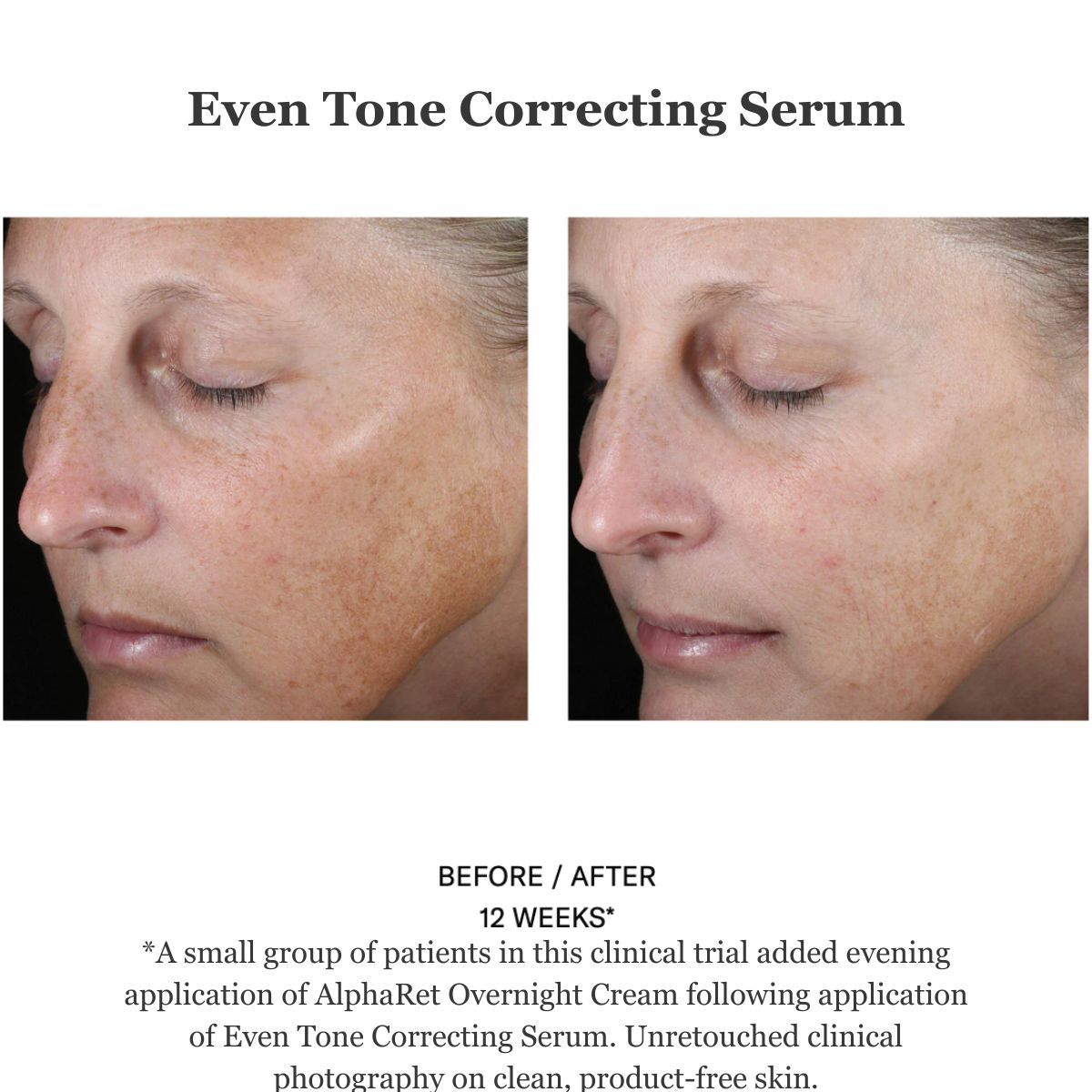 Even Tone Correcting Serum 50ml