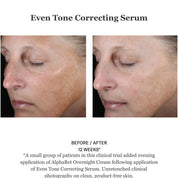 Even Tone Correcting Serum 50ml