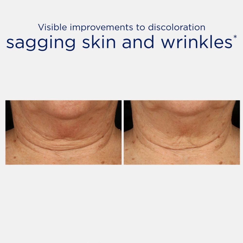 Triple Firming Neck Cream 80g