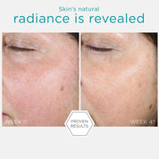 PHA Renewal Pads 60stk