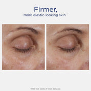 Intensive Eye Therapy 15g