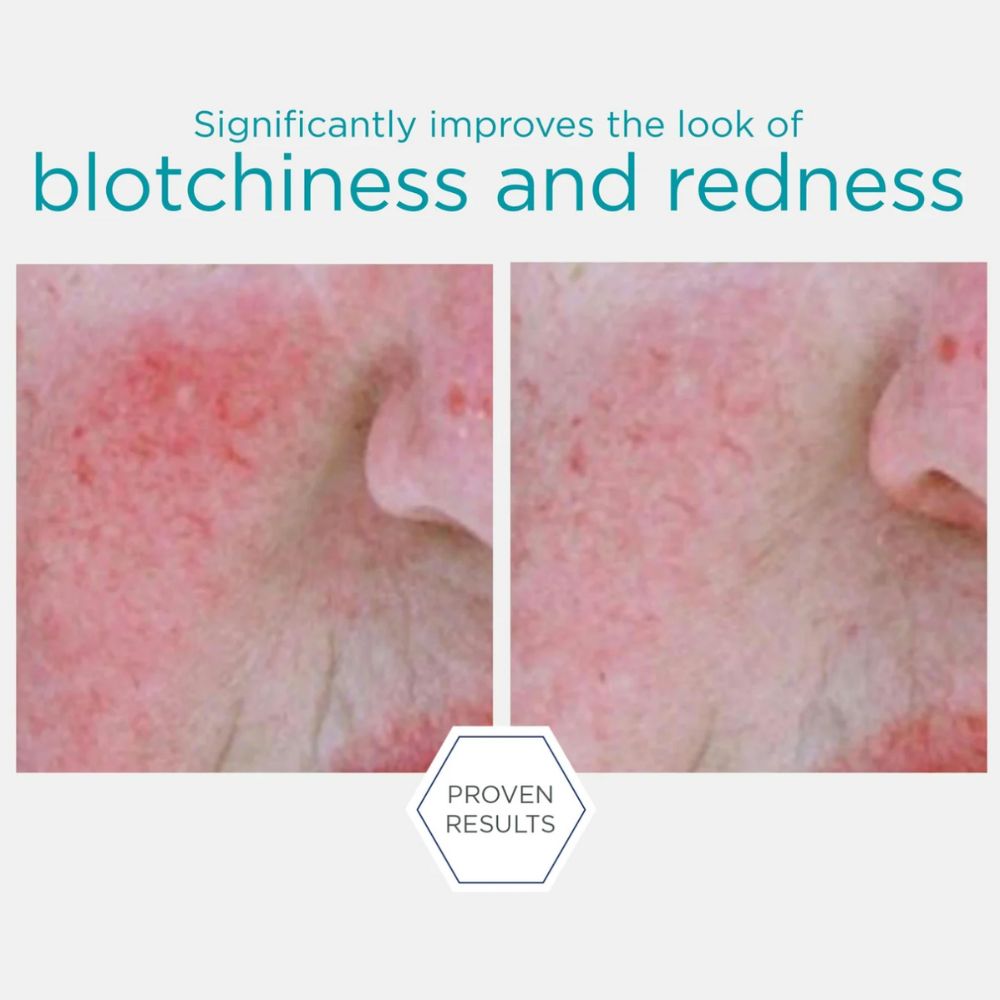 Redness Neutralizing Serum 29g