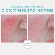 Redness Neutralizing Serum 29g