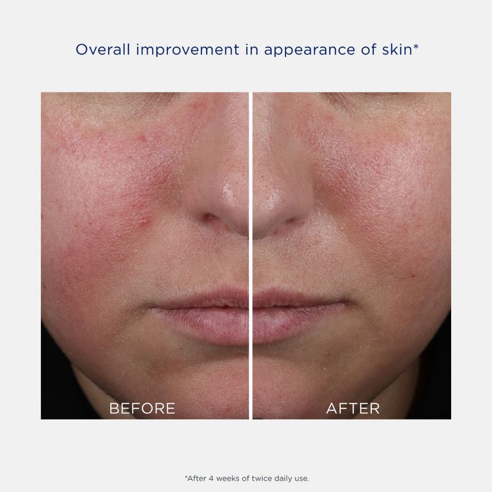 Mandelic Clarifying Hydragel 50ml