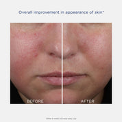 Mandelic Clarifying Hydragel 50ml