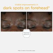 15% Vitamin C + PHA Serum 15ml