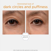 Brightening Eye Cream 15g