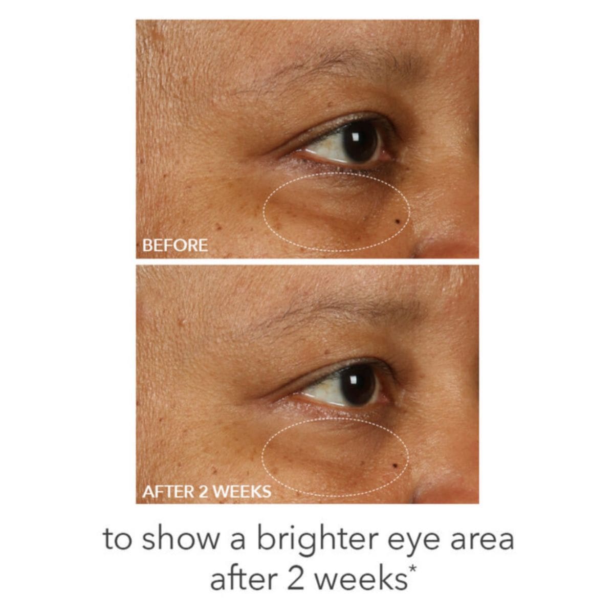 Fill + Repair Eye Cream 15ml