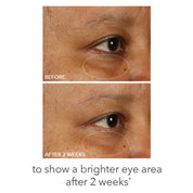 Fill + Repair Eye Cream 15ml
