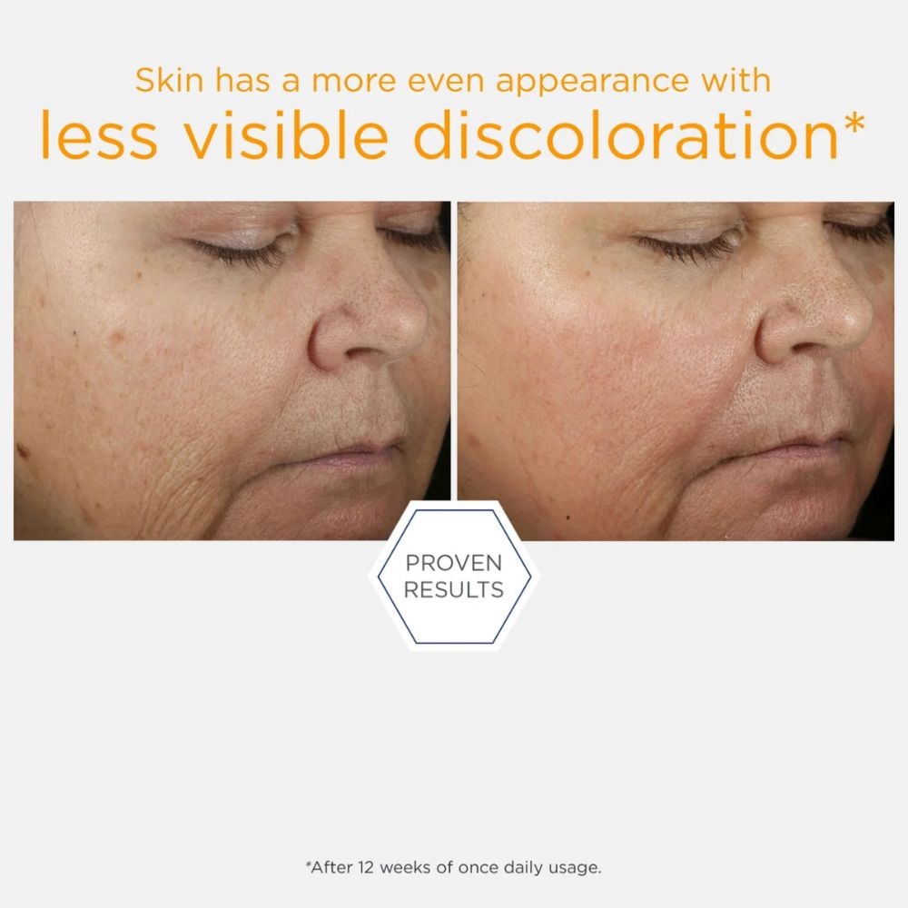 15% Vitamin C + PHA Serum 15ml