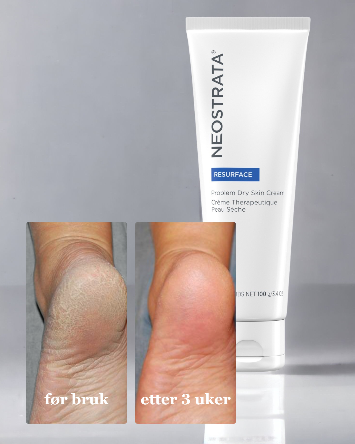 Problem Dry Skin