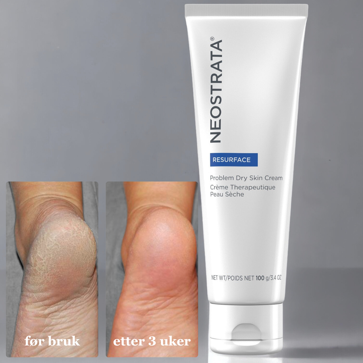 Problem_Dry_Skin_Cream_Neostrata_2.png