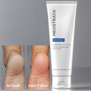 Problem Dry Skin Cream 100g