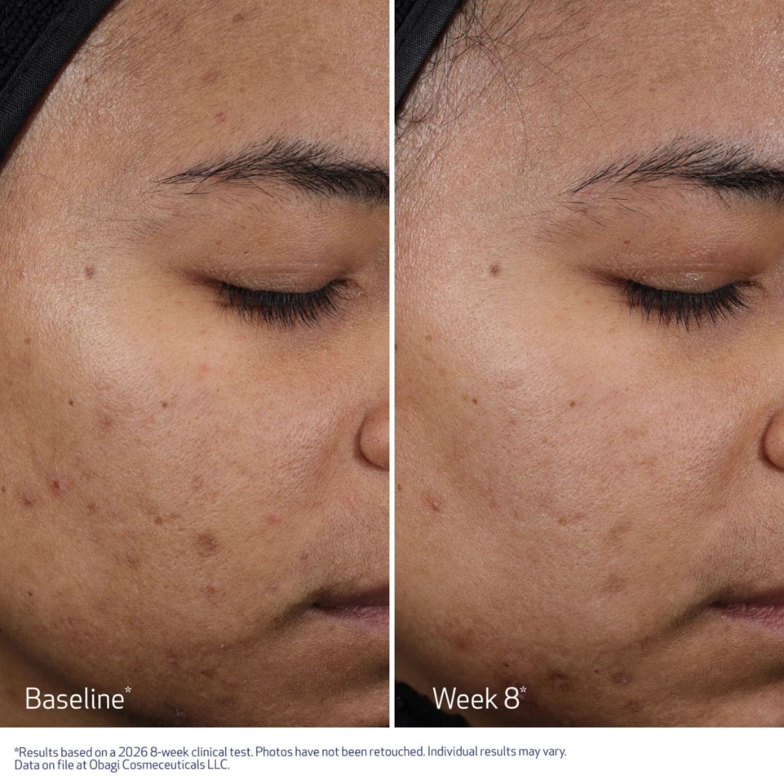 Resurfacing_Multi_Peel_Pads_10.jpg