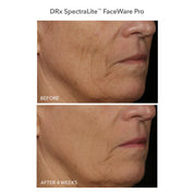 dr-dennis-gross-spectralite-faceware-pro